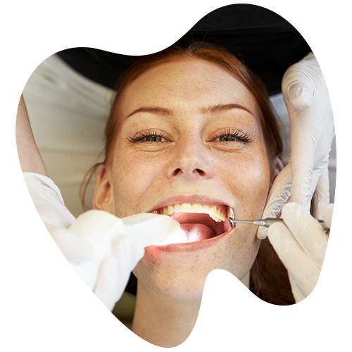 Paradentose behandling